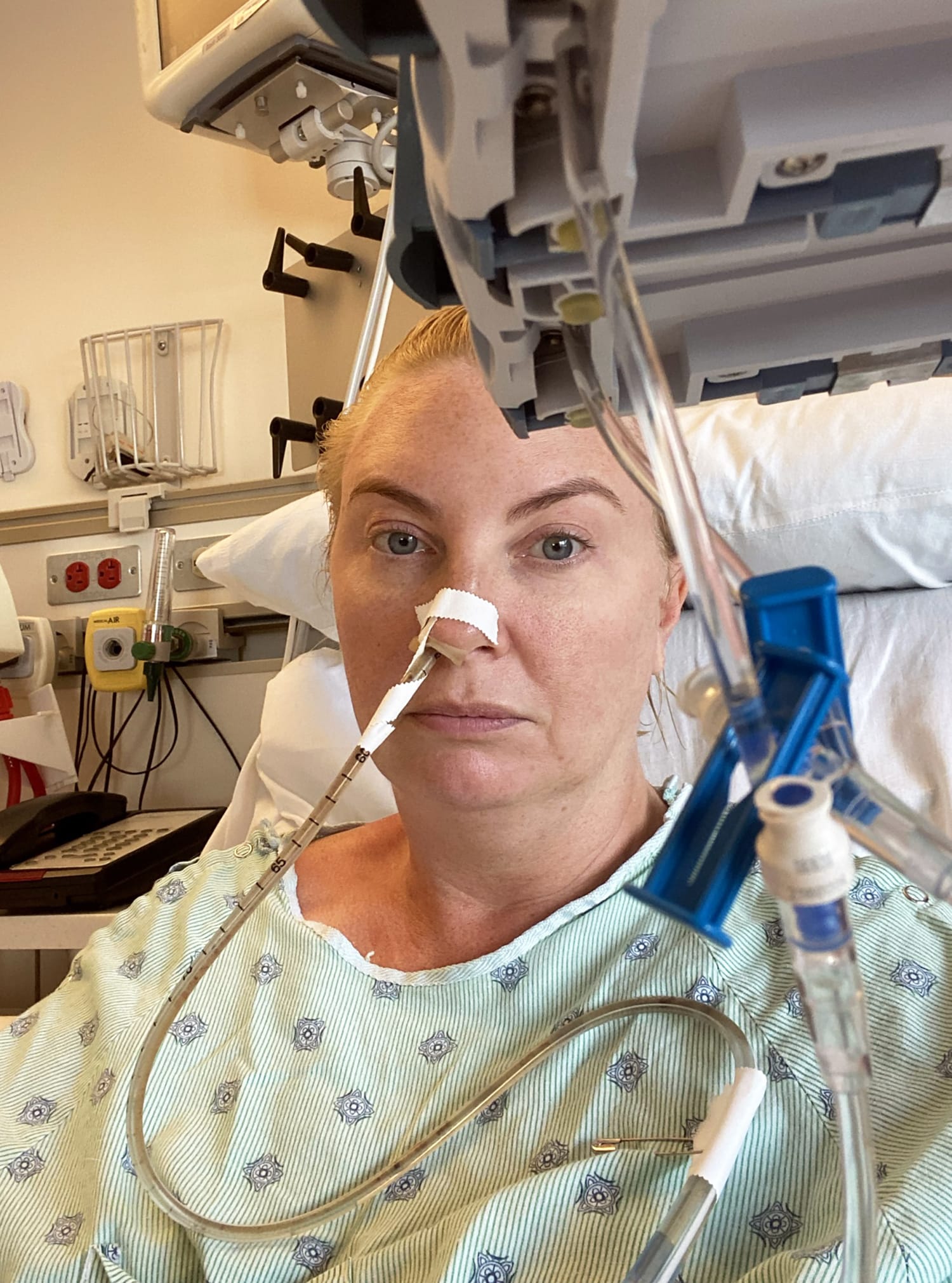 Woman Misdiagnosed with Eating Disorder Before Achalasia Diagnosis and Treatment