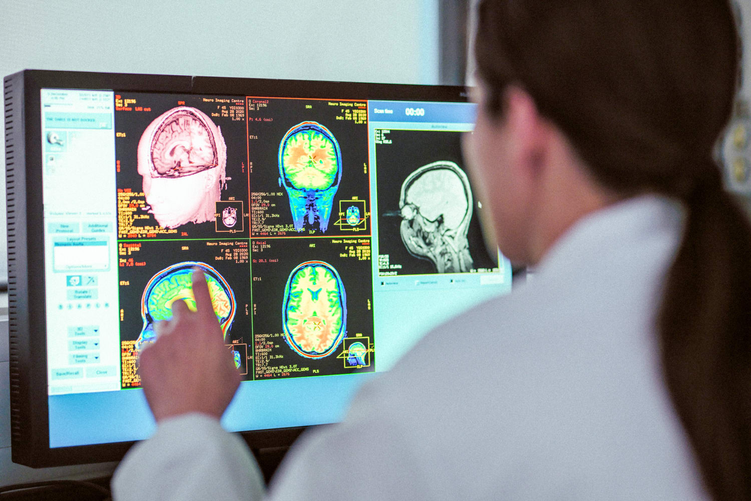 Study Finds No Mystery Neurological Disease in New Brunswick Cluster of Cases
