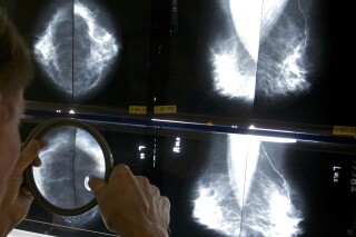 Early-Onset Cancers Increasing: Study Reveals Rise in Breast, Colorectal, Kidney, Uterine Cancers