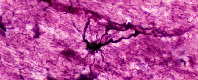 Psychedelics Impact: Reduce Inflammation, Reset Brain-Immune Interactions, Treat Mental Disorders