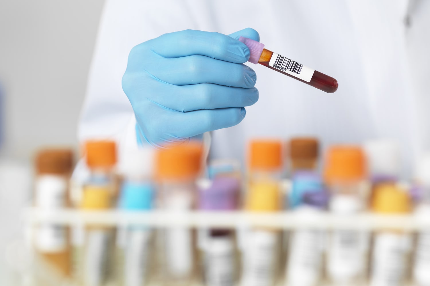 Obicetrapib Shows Promise in Lowering Cholesterol, Reducing Cardiovascular Risk in Trials